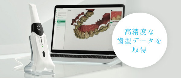 高精度な歯型データを取得